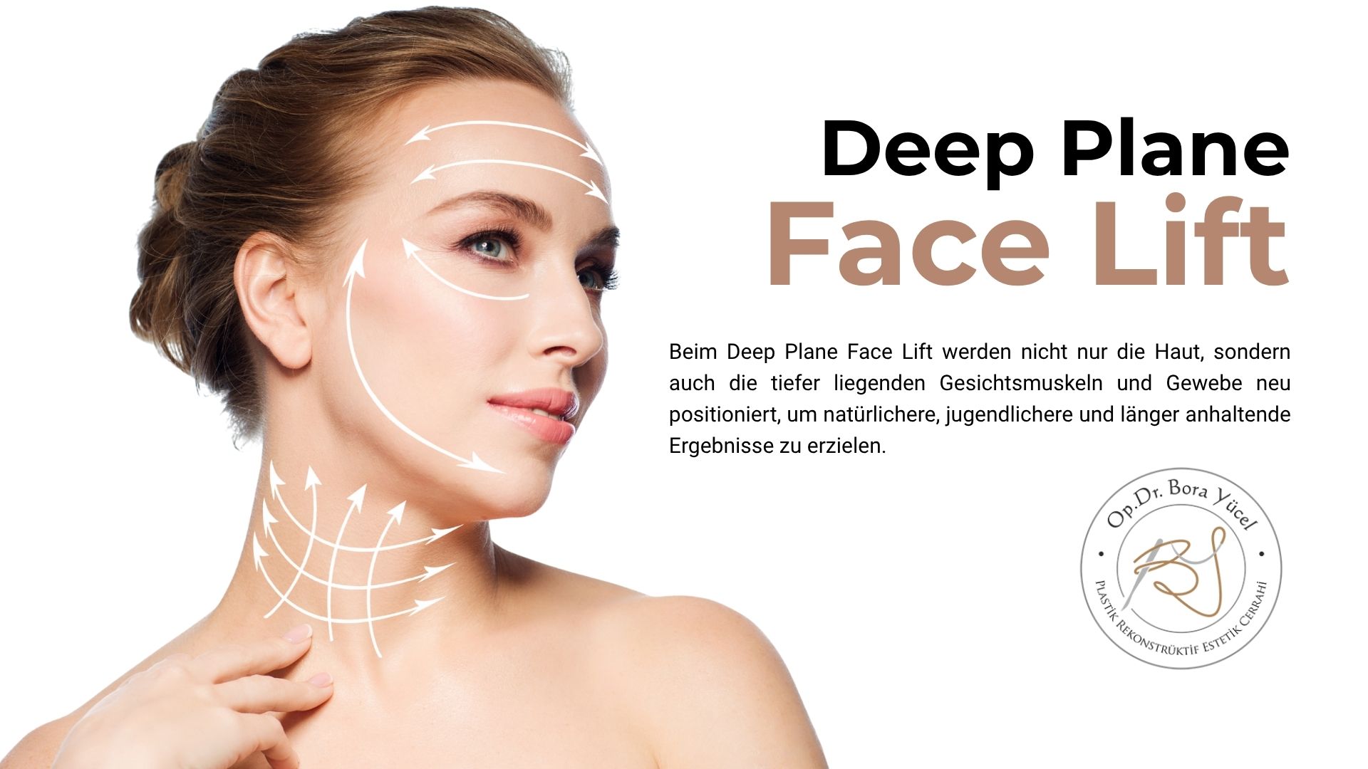 deep-plane-facelifting-turkei-antalya