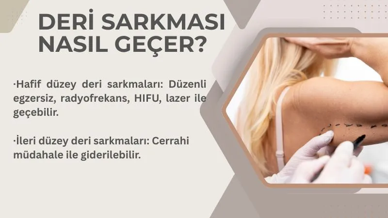 Deri Sarkması Nasıl Geçer?