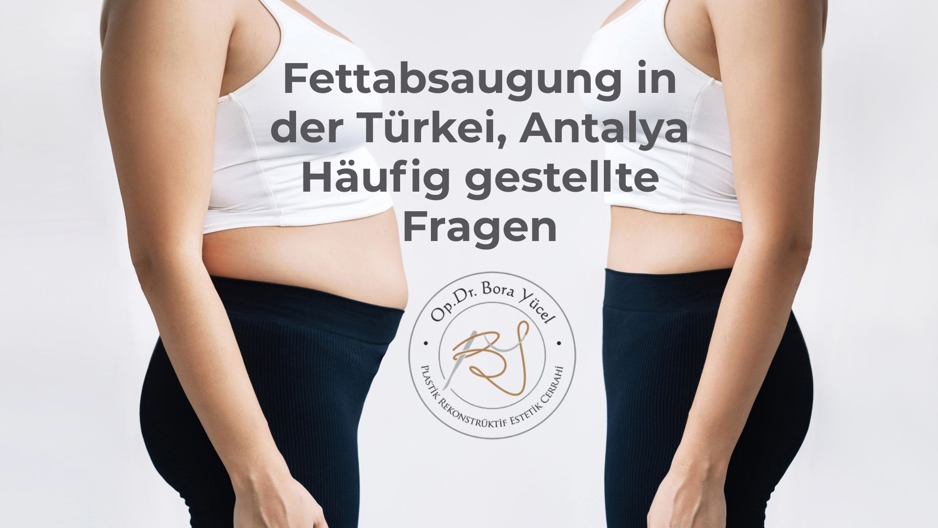 Fettabsaugung in der Türkei, Antalya: Häufig gestellte Fragen