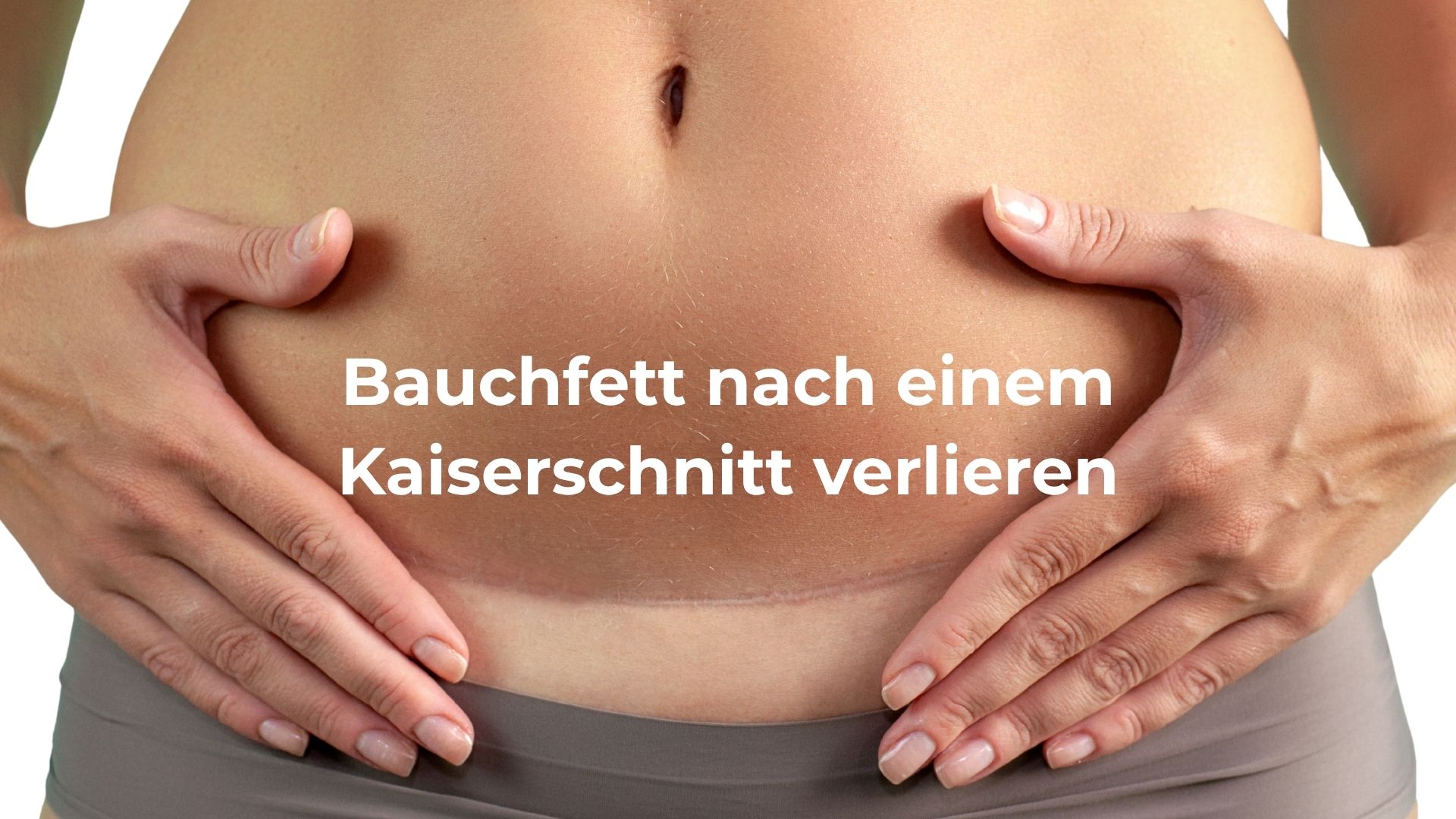Wie wird man einen hängenden Bauch nach einem Kaiserschnitt los?