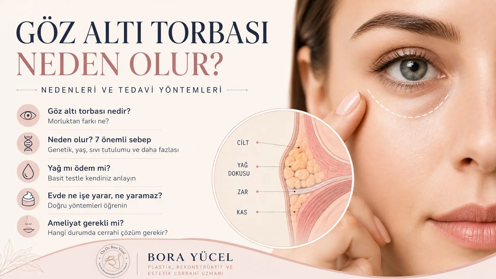 Göz altı torbası nedenleri ve tedavi yöntemleri