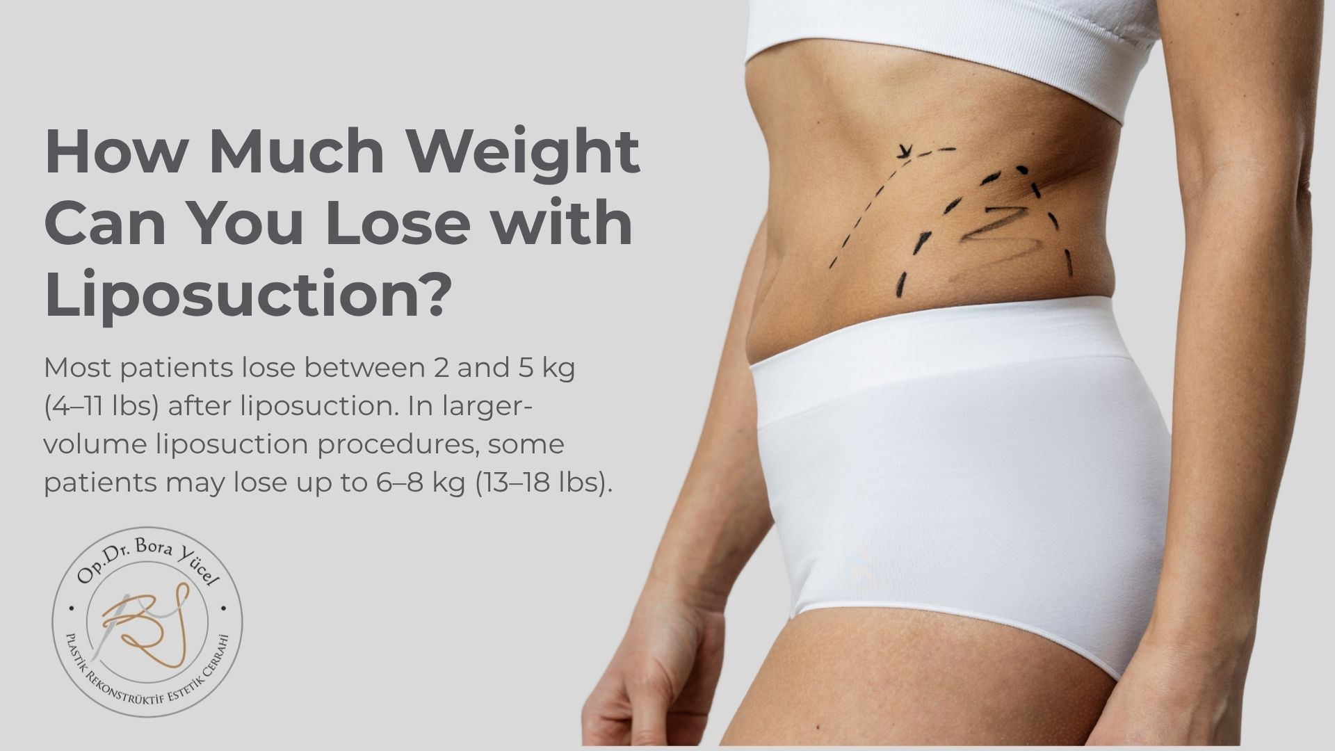 how-much-weight-can-you-lose-with-liposuction-in-turkey?
