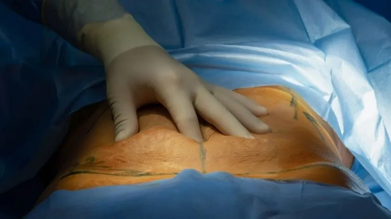 Karın Germe Ameliyatı Zor mu? Karın germe sonrası iyileşme süreci