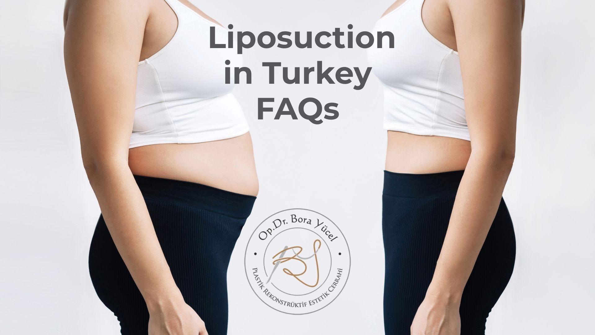 Liposuction in Turkey, Antalya: Frequently Asked Questions