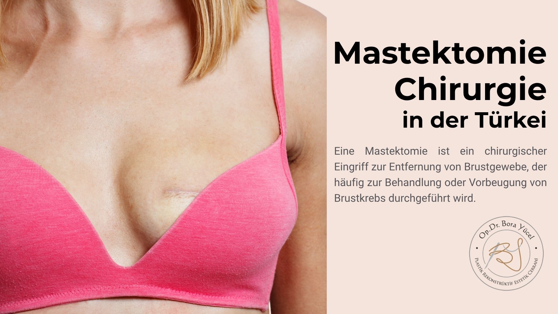 brustentfernung-mastektomie-turkei