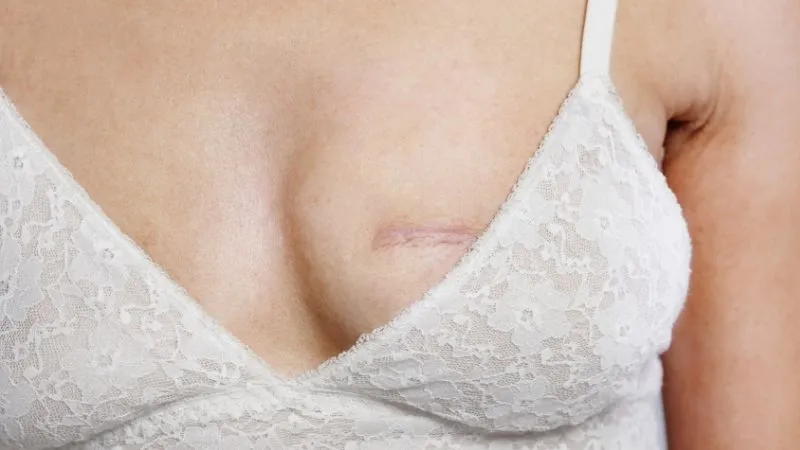 Antalya Meme Estetiği