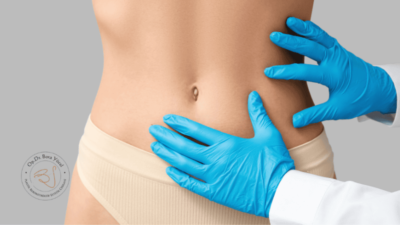 Mini Karın Germe Antalya