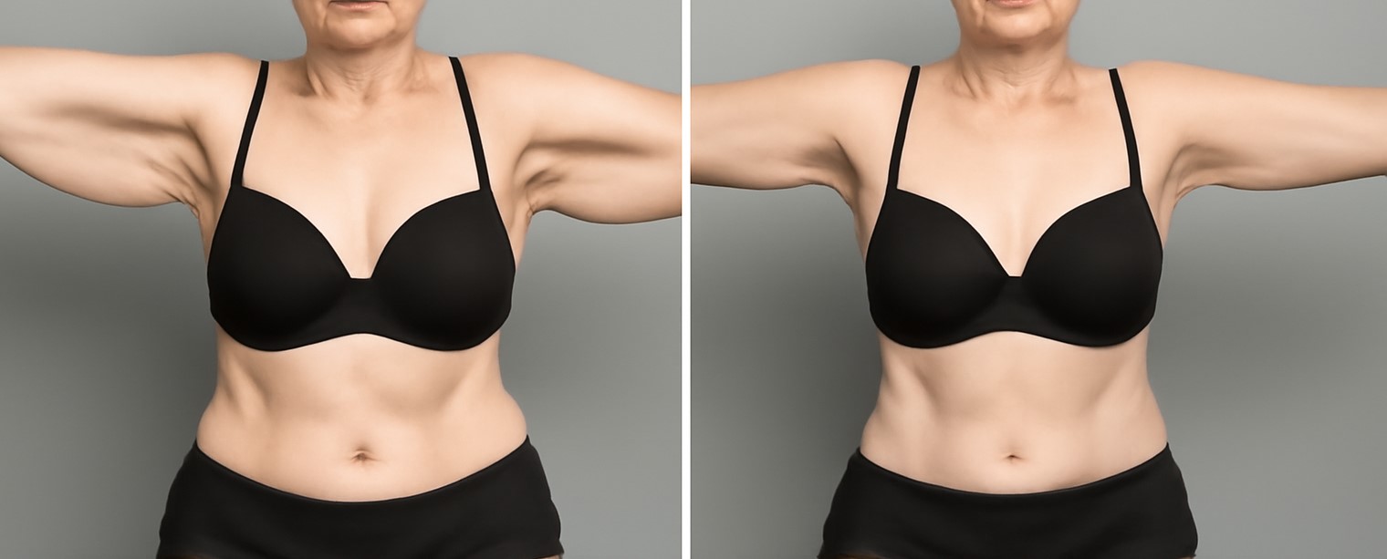 Before and After-3