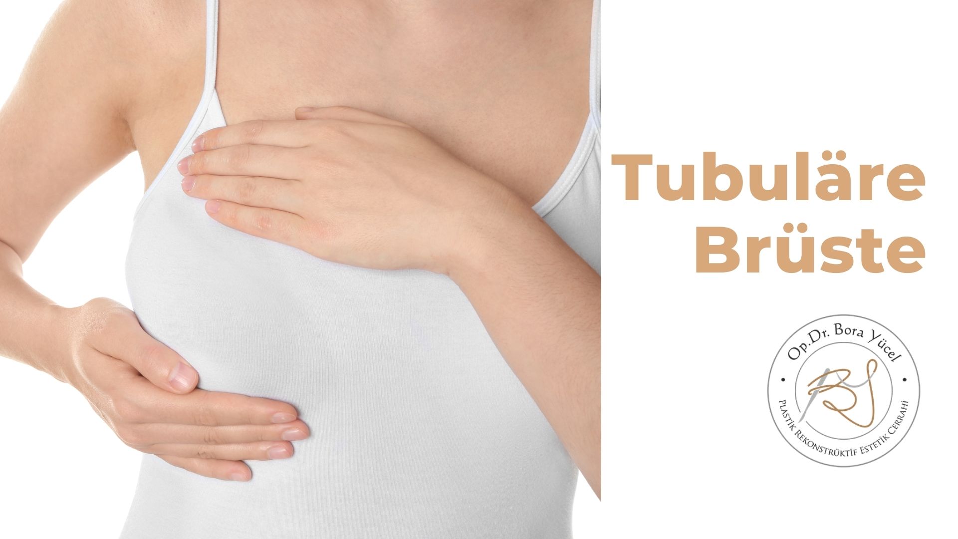 Tubuläre Brüste