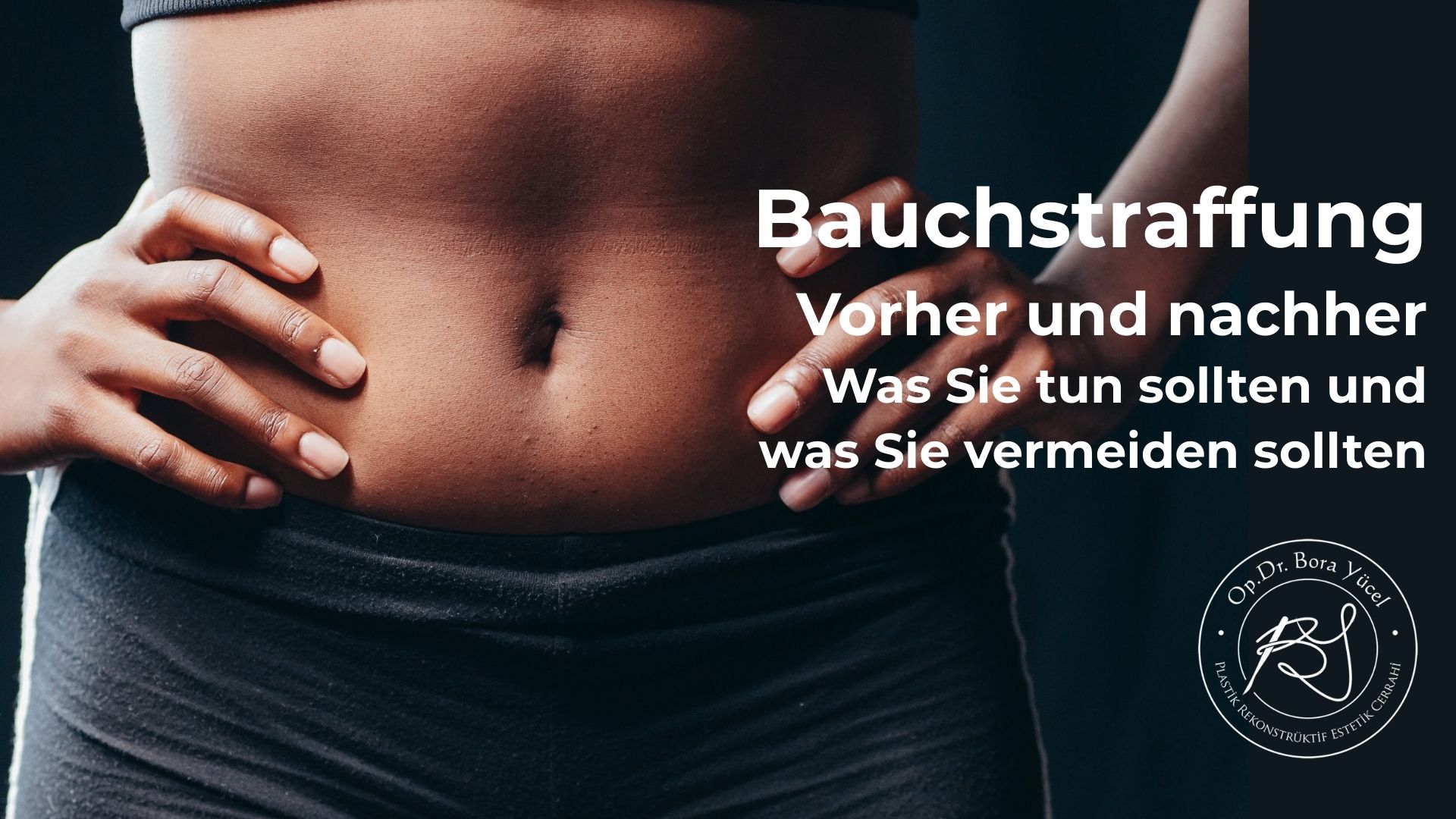  Was Sie vor und nach einer Bauchstraffung tun und vermeiden sollten 