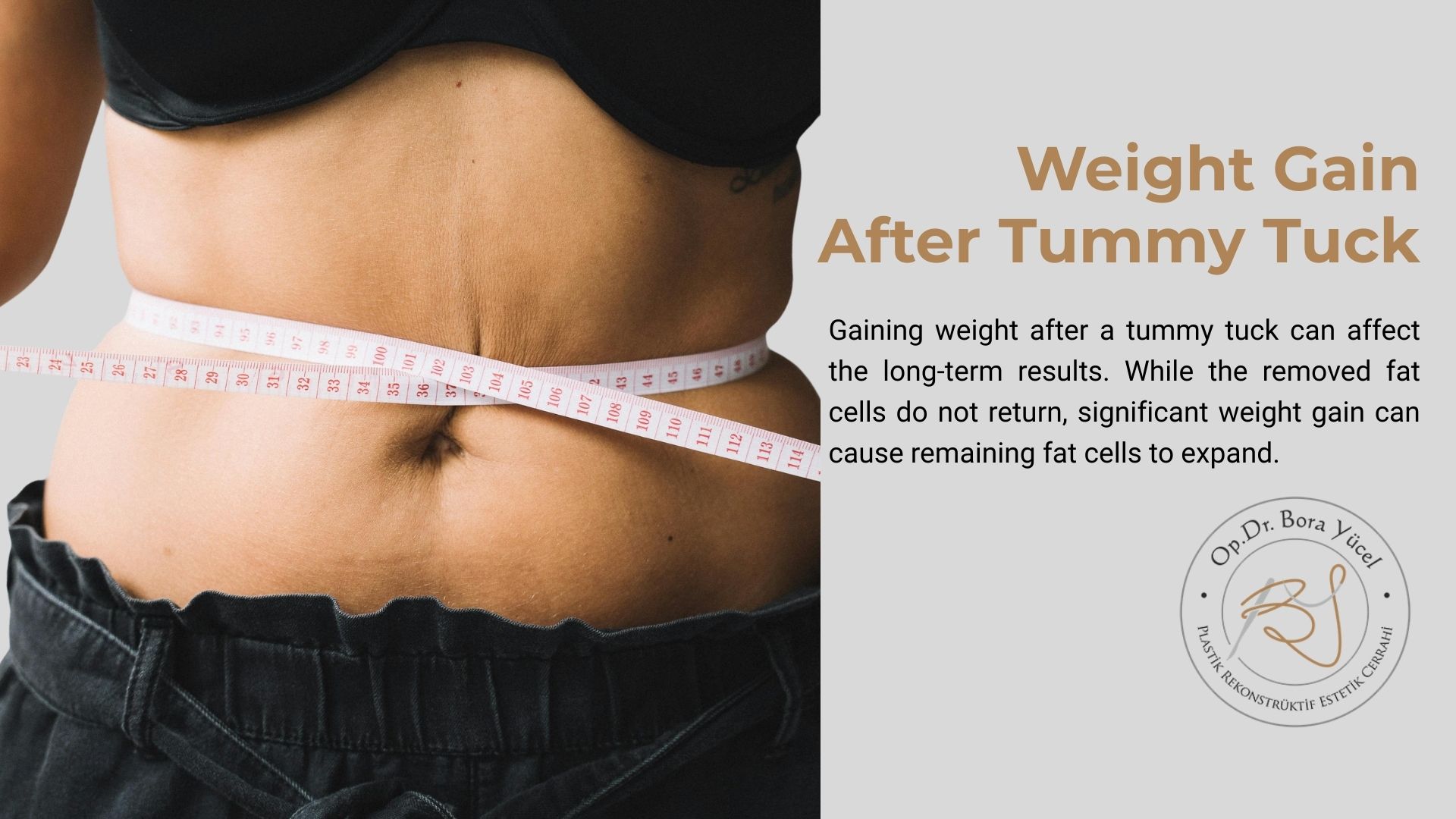 weight-gain-after-tummy-tuck