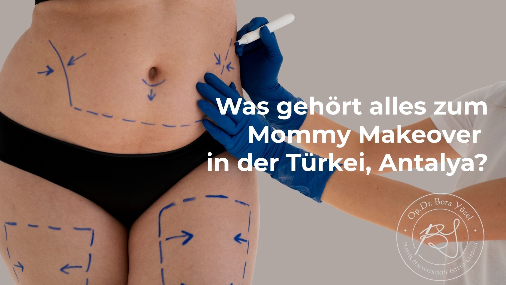 was-gehort-alles-zum-mommy-makeover-in-turkei-antalya?
