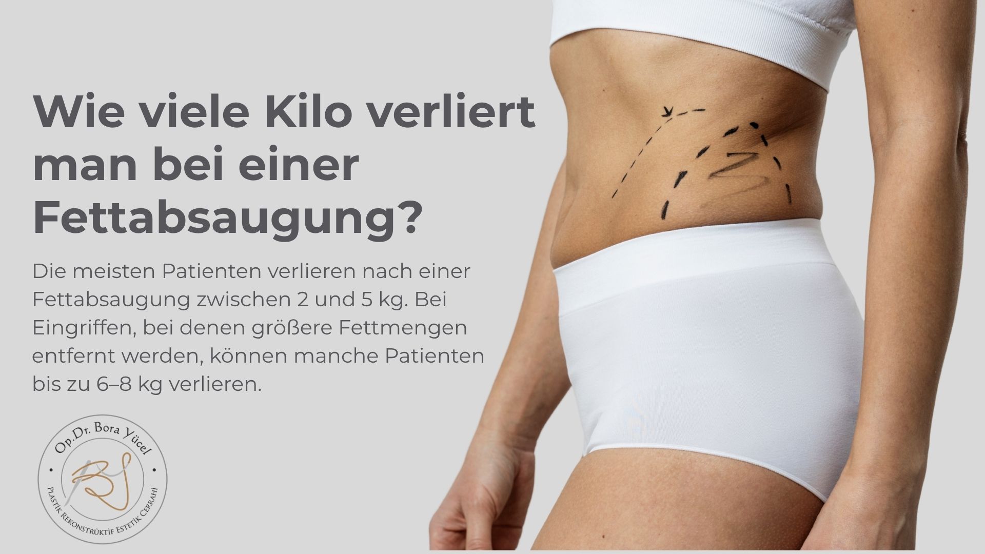 wie-viele-kilo-verliert-man-bei-einer-fettabsaugung?