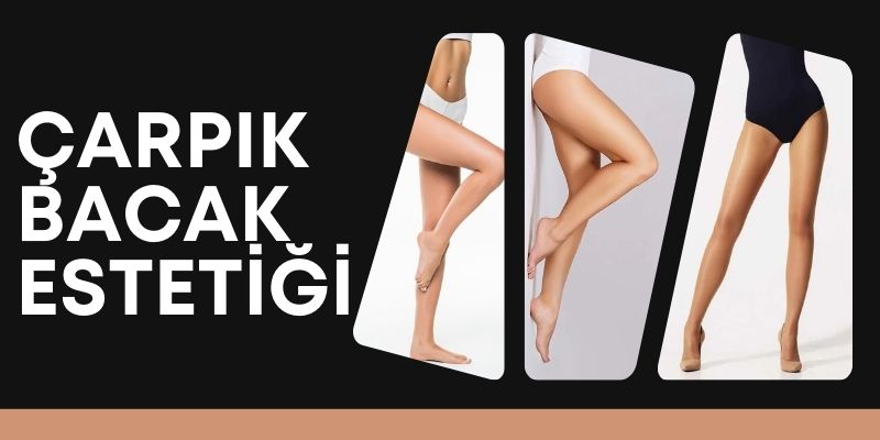 Çarpık bacak estetik ameliyatı Antalya