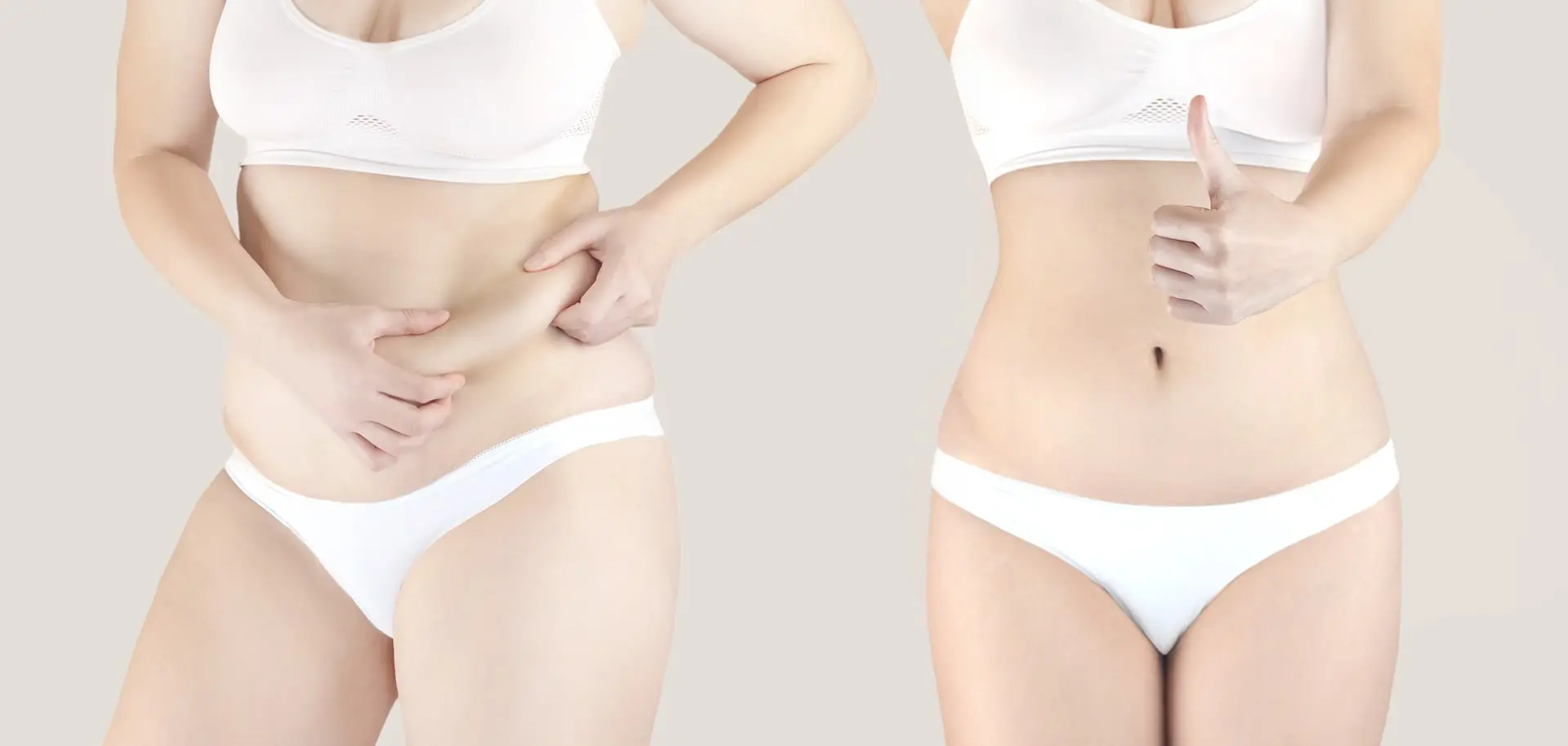 Reverse tummy tuck before after in Turkey