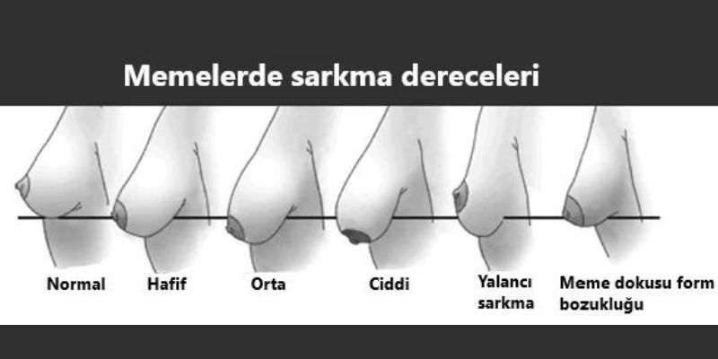 Antalya sarkık memelere bitkisel çözüm