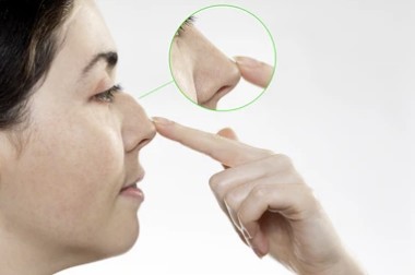 Benefits of nose tip rhinoplasty