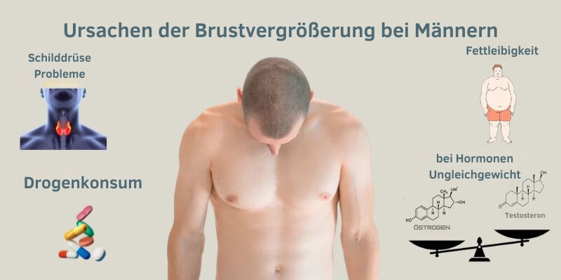 Ursachen einer Brustvergrößerung bei Männern