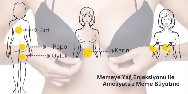 Antalya Yağ enjeksiyonu ile Ameliyatsız Meme Büyütme