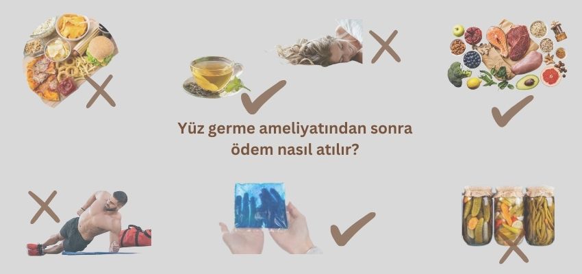 Yüz germe ameliyatından sonra ödem nasıl atılır? - Antalya